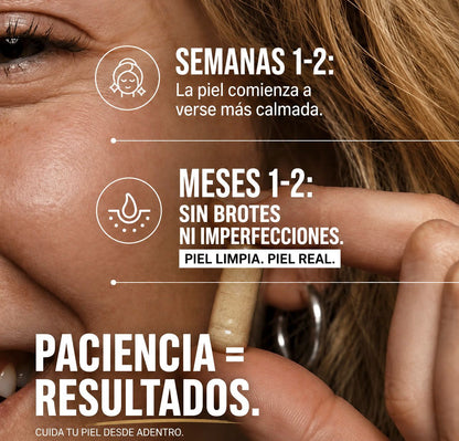 CLEAR ADVANCE™ – Elimina el Acne Hormonal